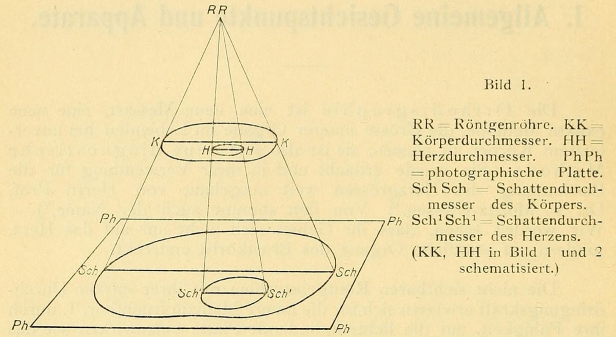 Diagram of X-rays diverging from a tube through a body, casting an enlarged shadow on the plate