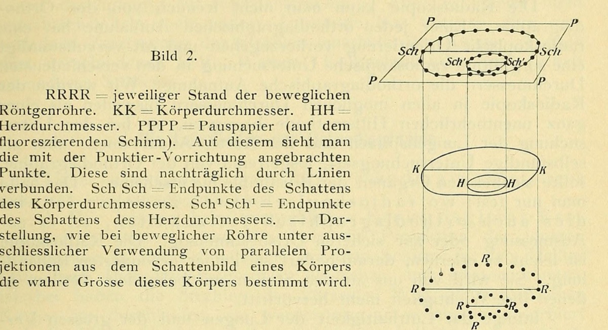Diagram of the orthodiagraph: parallel rays trace the outline of the body and heart at true size